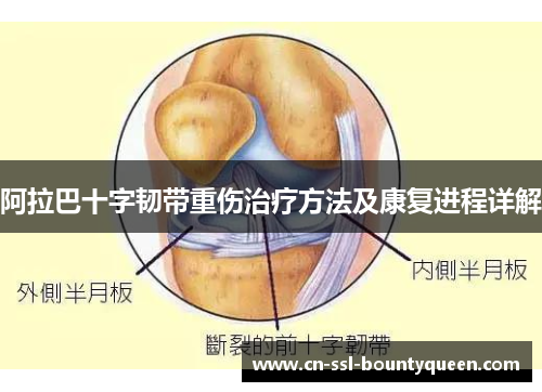 阿拉巴十字韧带重伤治疗方法及康复进程详解 阿拉巴十字韧带重伤治疗方法及康复进程详解